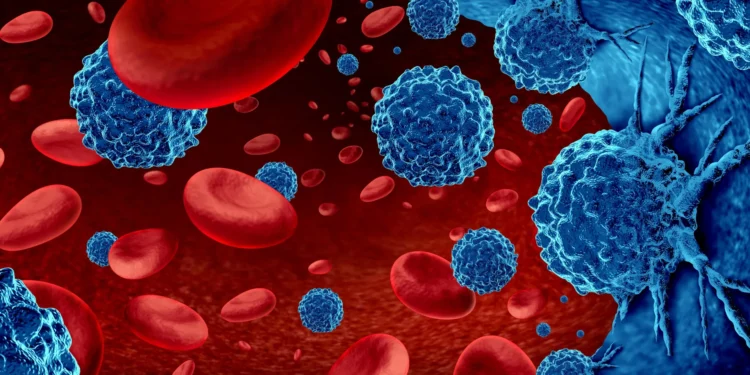 Qan dövranının zəifliyi xərçəngin sürətlə böyüməsinə səbəb olur